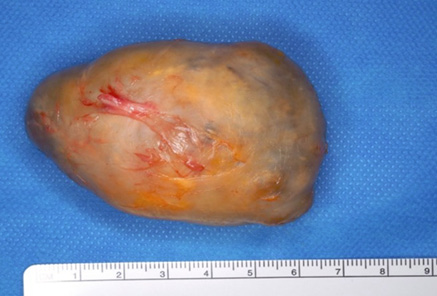 A piece of meat with a blue cloth underneath it.
Description generated by AI